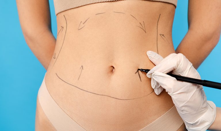 Close up of doctor hand making dotted lines on female body. Isolated on blue background